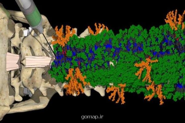 یک درمان تزریقی برای ترمیم صدمه های نخاعی