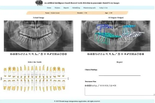 توسعه سامانه هوشمند تحلیل تصاویر دندانپزشکی در دانشگاه تهران