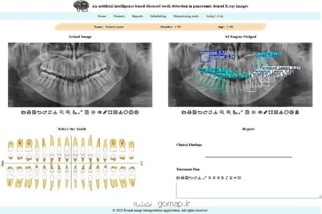 توسعه سامانه هوشمند تحلیل تصاویر دندانپزشکی در دانشگاه تهران