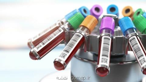 توسعه یك آزمایش خون كه آلزایمر را یك دهه زودتر پیش بینی می كند!